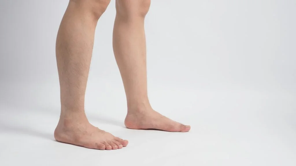 Person with flat foot