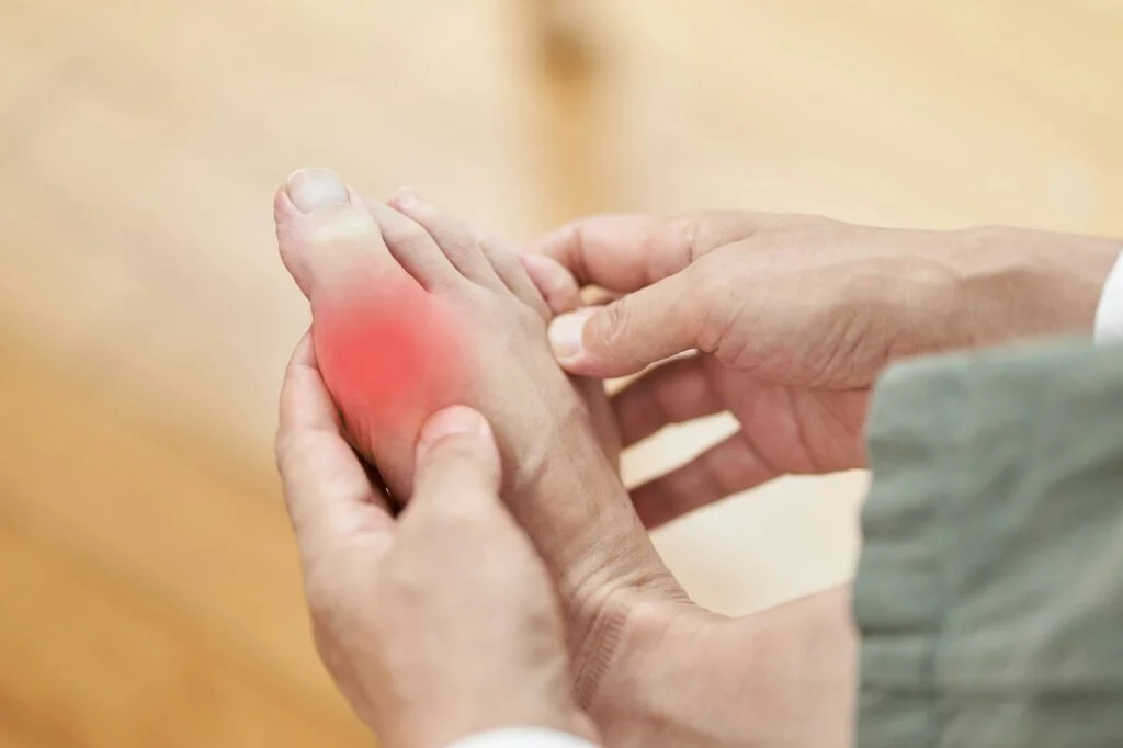 Foot with gout pain